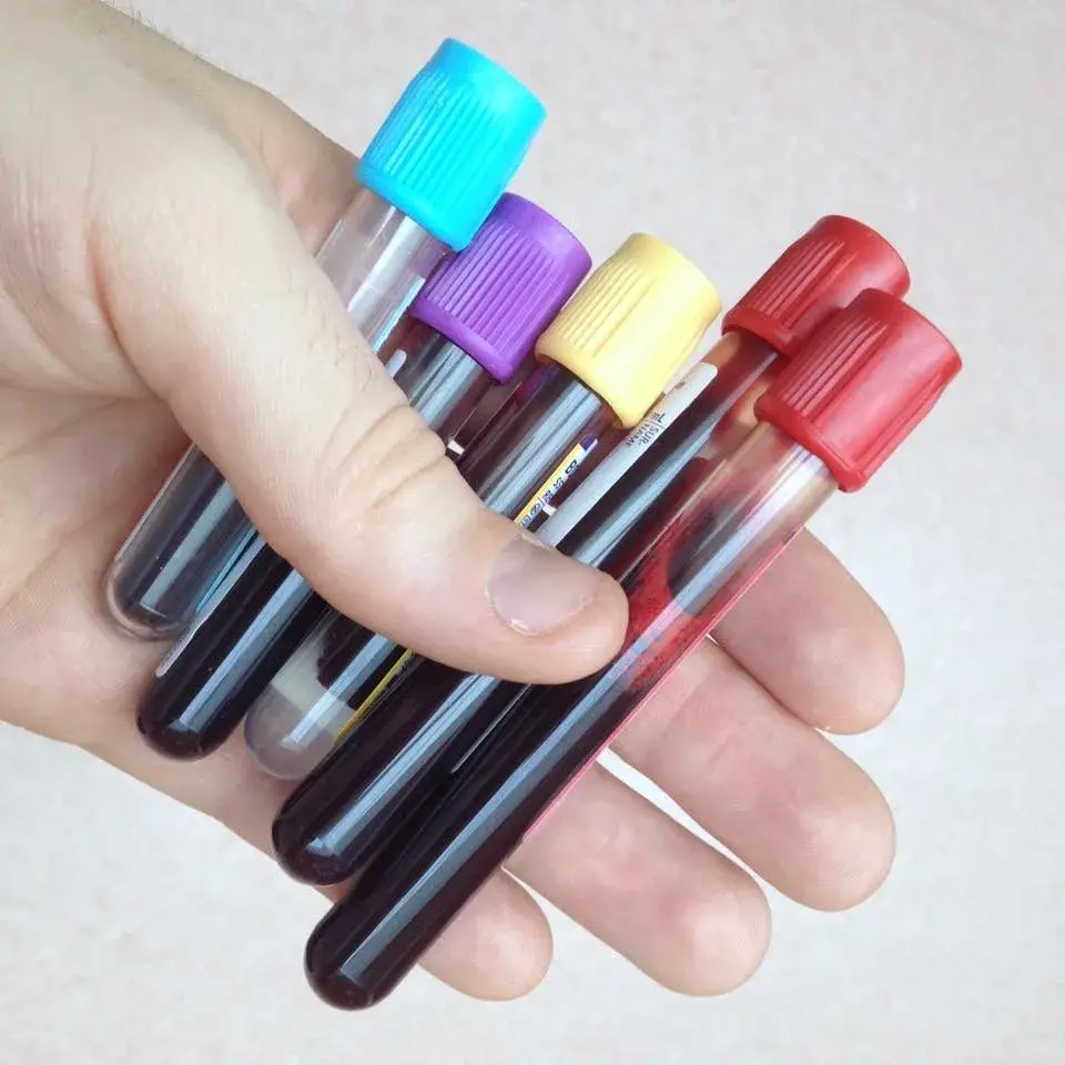 Main tenant plusieurs tubes sous vide remplis de sang, bouchons de couleurs différentes